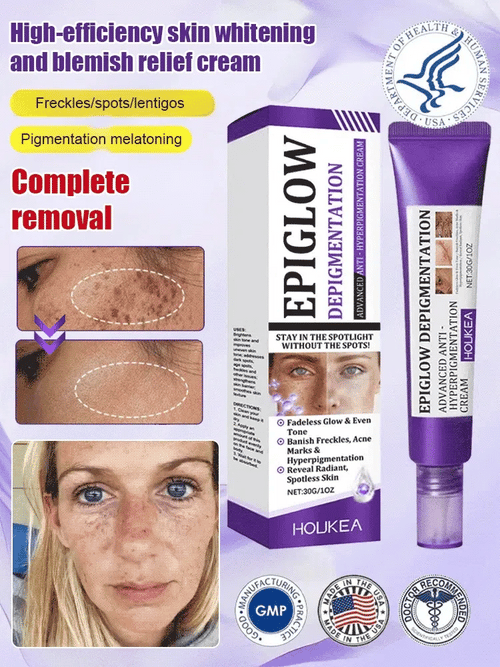 Highly effective whitening and spot-lightening cream