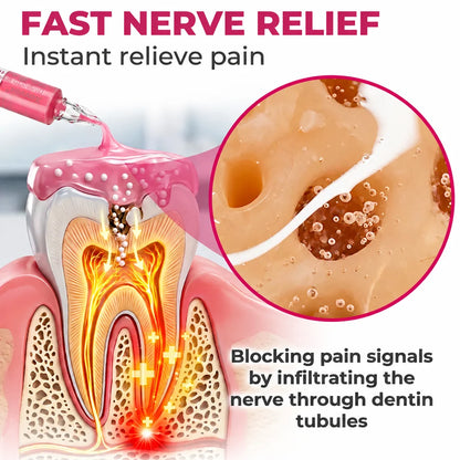 DenPerm Cavity-Repair Natural Enamel Filling Gel