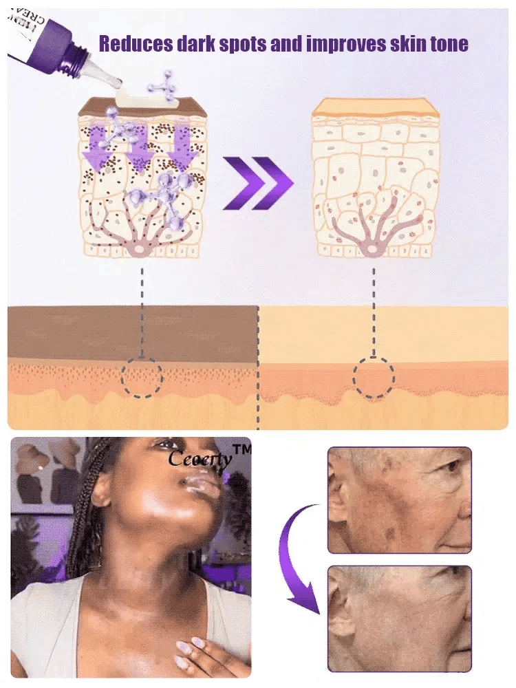Highly effective whitening and spot-lightening cream