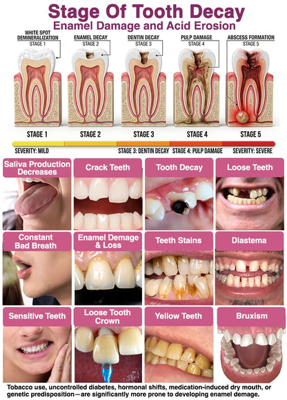 DenPerm Cavity-Repair Natural Enamel Filling Gel